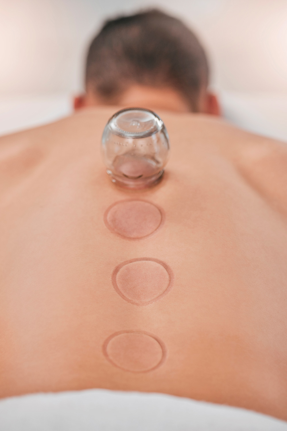 Impressionen - Schröpfmassage aus Arnsberg